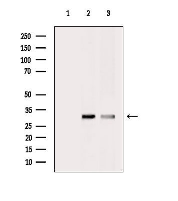 CTRP2 Antibody in Western Blot (WB)