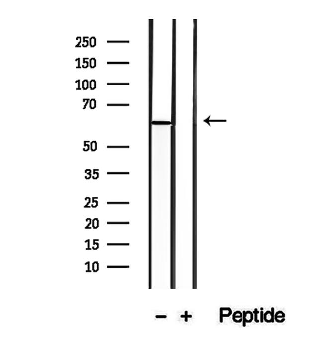 CD26 Antibody in Western Blot (WB)