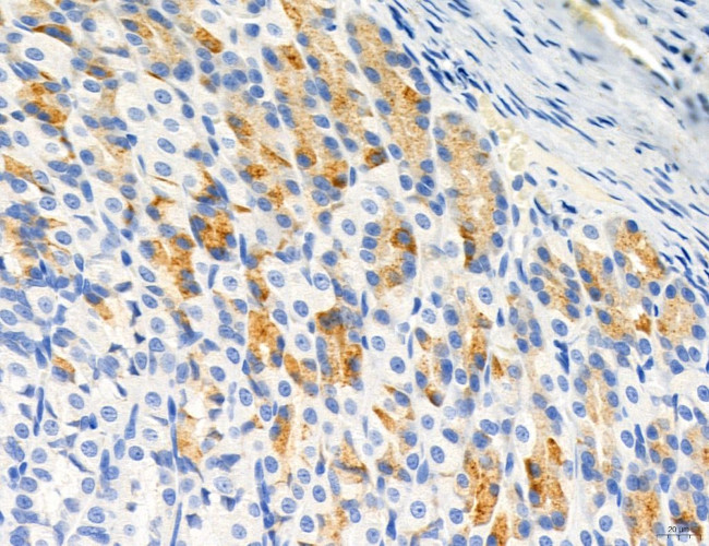 CD44 Antibody in Immunohistochemistry (Paraffin) (IHC (P))