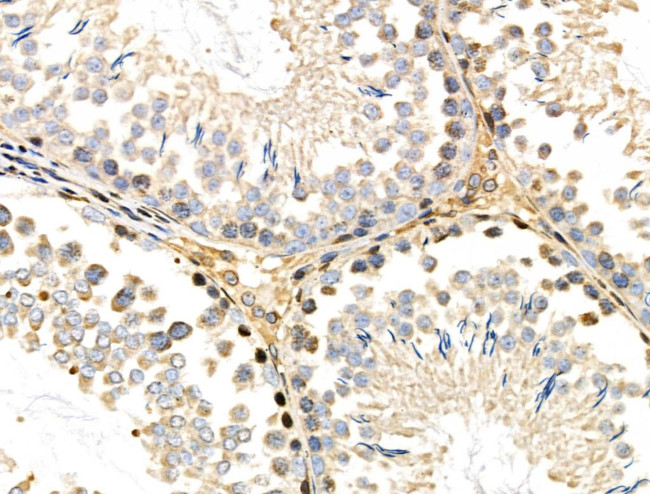 CDK8 Antibody in Immunohistochemistry (Paraffin) (IHC (P))