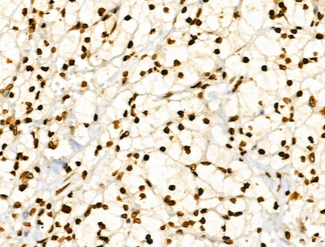 CDK8 Antibody in Immunohistochemistry (Paraffin) (IHC (P))