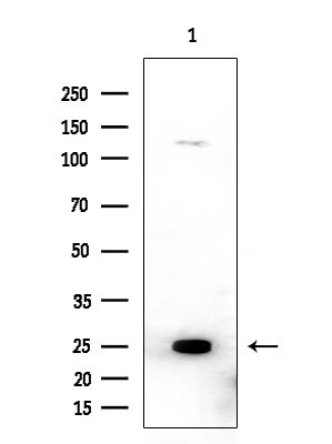 Cofilin 1/2 Antibody in Western Blot (WB)