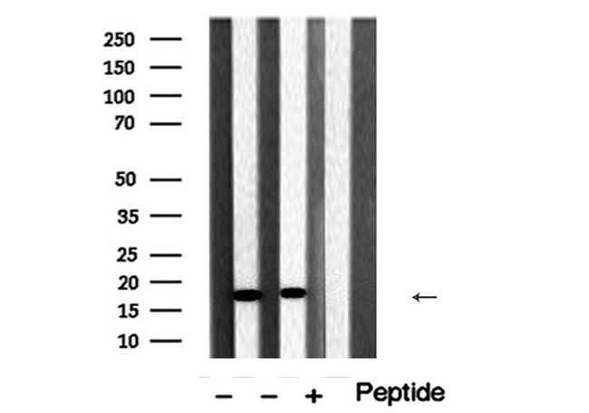 Cofilin 1/2 Antibody in Western Blot (WB)