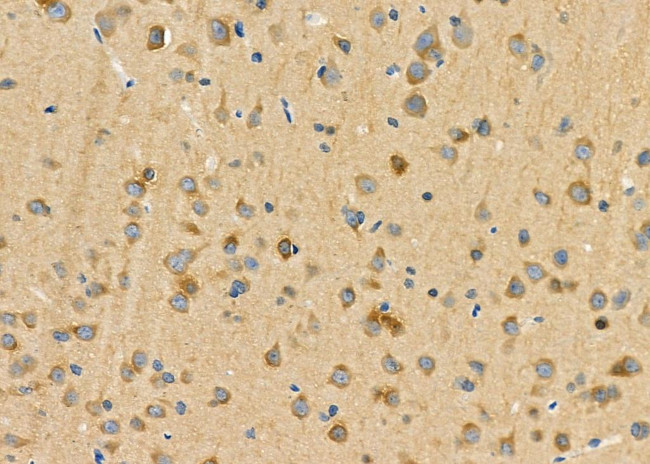 CRABP2 Antibody in Immunohistochemistry (Paraffin) (IHC (P))