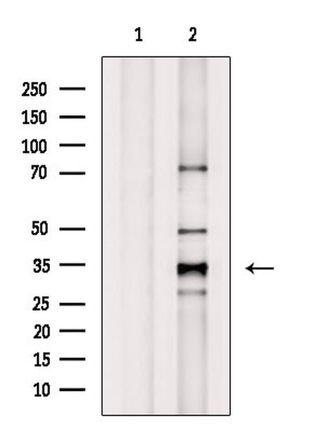 CREM Antibody in Western Blot (WB)