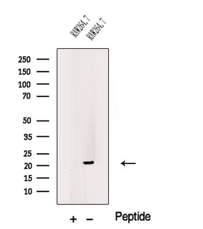 CSF2 Antibody in Western Blot (WB)