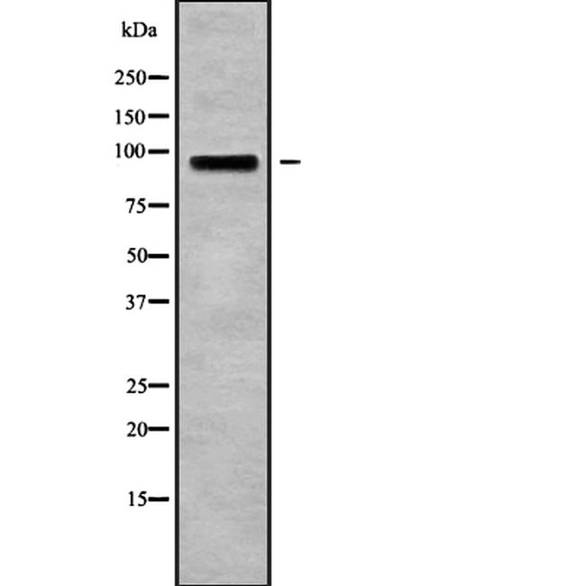 CSF3R Antibody in Western Blot (WB)