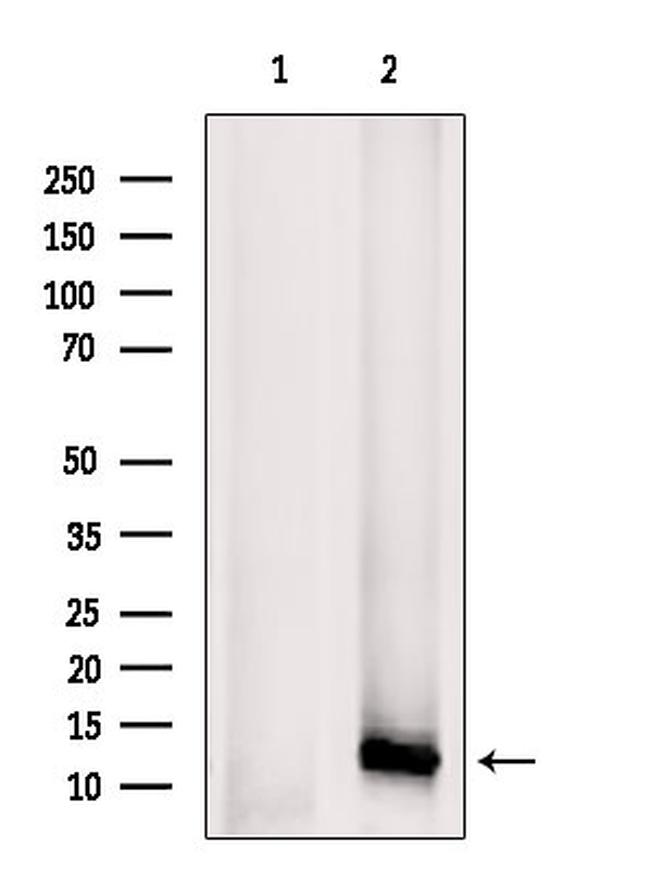 CXCL5 Antibody in Western Blot (WB)