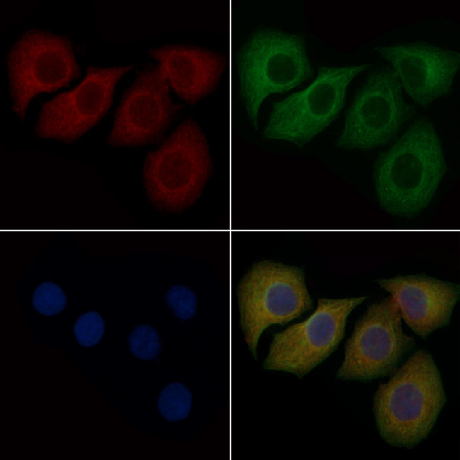 PPBP Antibody in Immunocytochemistry (ICC/IF)