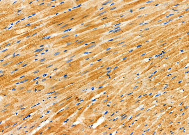 PPBP Antibody in Immunohistochemistry (Paraffin) (IHC (P))