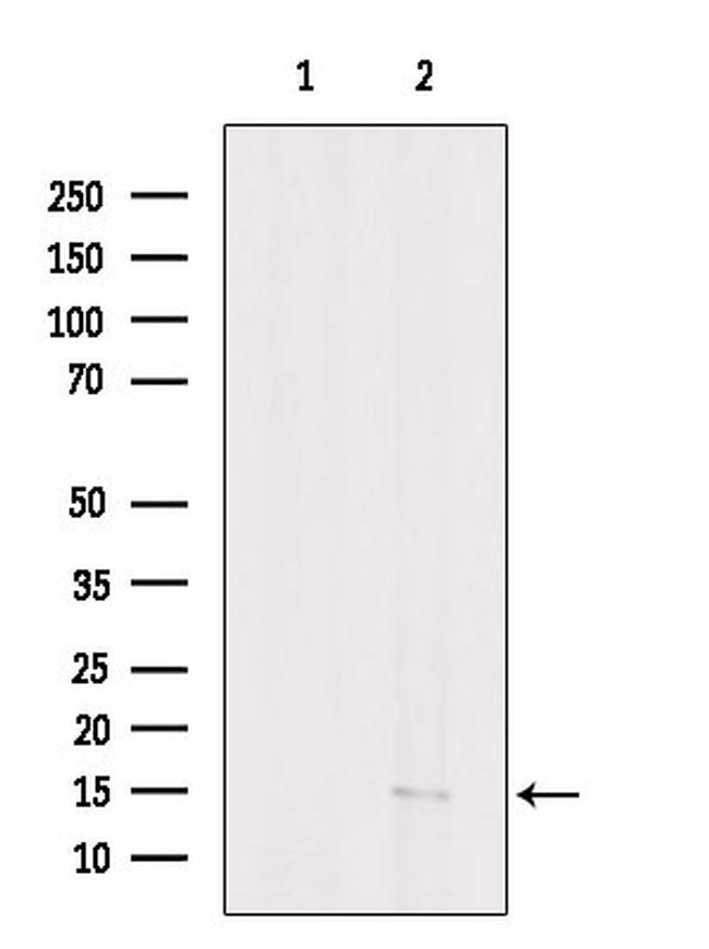 PPBP Antibody in Western Blot (WB)