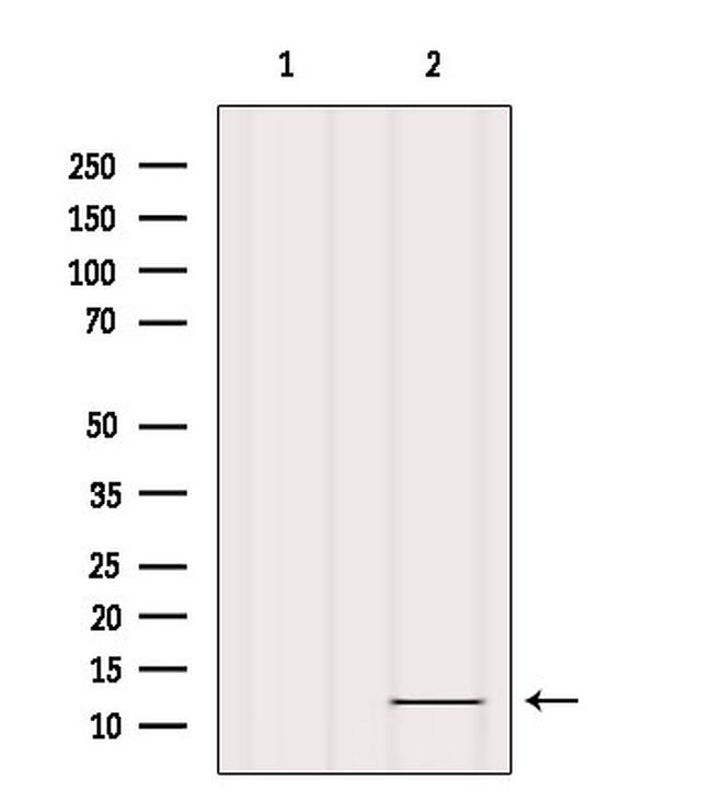 COX6A1 Antibody in Western Blot (WB)