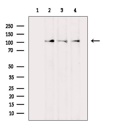 MCK10 Antibody in Western Blot (WB)