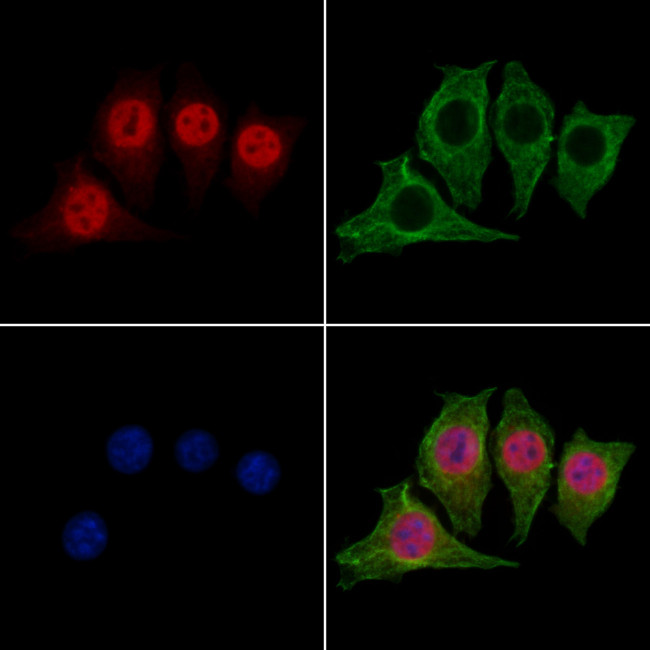 DFFB Antibody in Immunocytochemistry (ICC/IF)