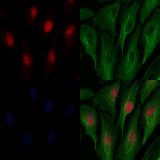 DFFB Antibody in Immunocytochemistry (ICC/IF)