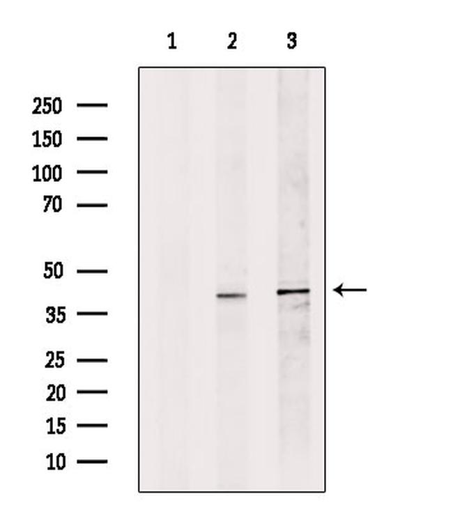 DFFB Antibody in Western Blot (WB)