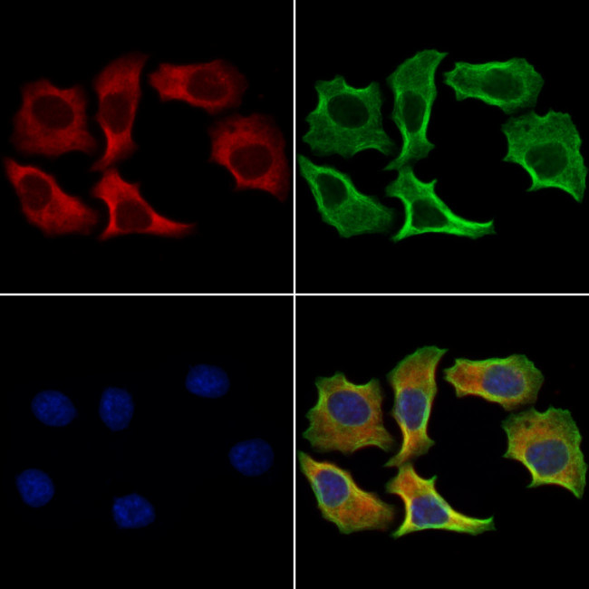 DHH Antibody in Immunocytochemistry (ICC/IF)