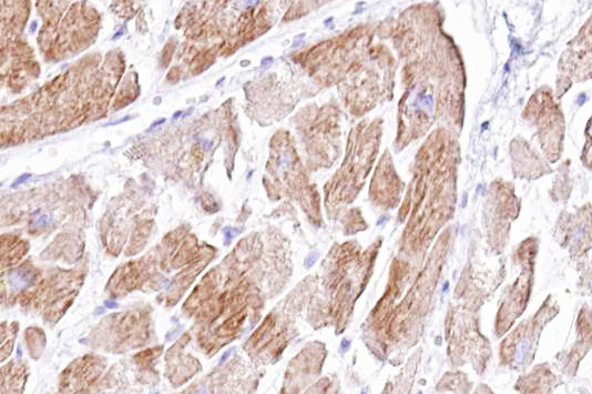 DLL1 Antibody in Immunohistochemistry (Paraffin) (IHC (P))