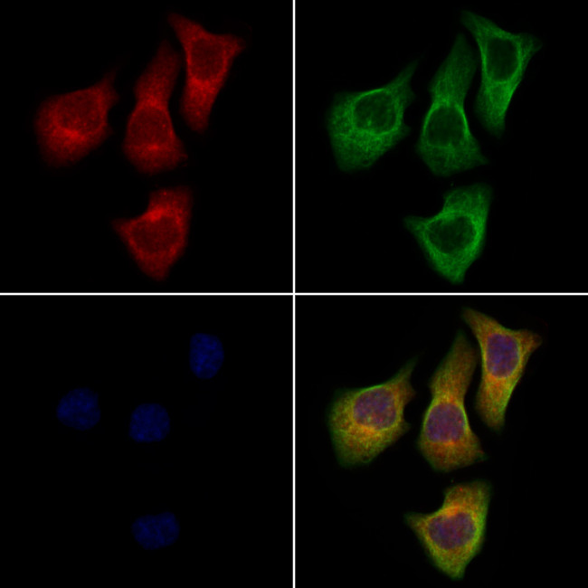 DPP6 Antibody in Immunocytochemistry (ICC/IF)