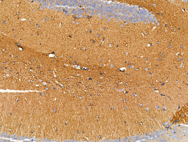 DPP6 Antibody in Immunohistochemistry (Paraffin) (IHC (P))