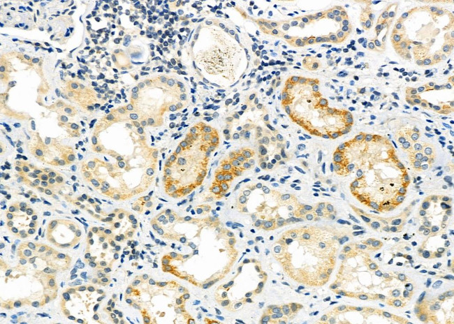 DYNC1H1 Antibody in Immunohistochemistry (Paraffin) (IHC (P))