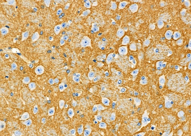 DYNC1H1 Antibody in Immunohistochemistry (Paraffin) (IHC (P))