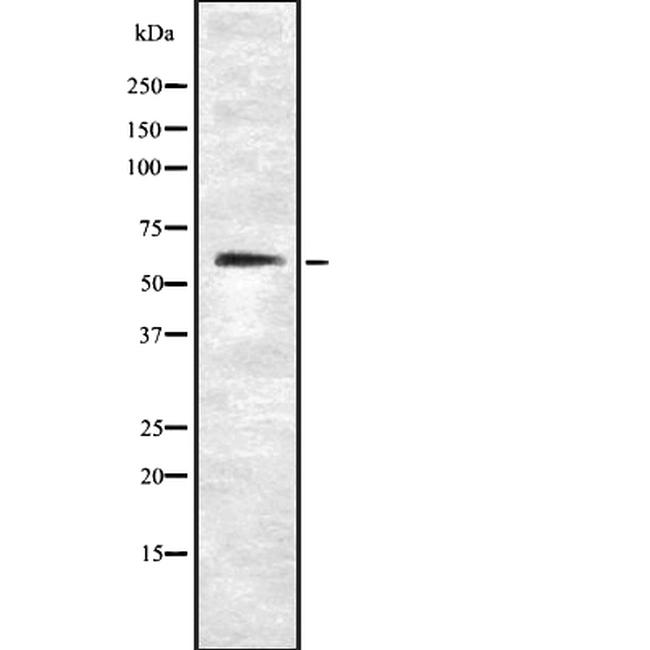 EAAC1 Antibody in Western Blot (WB)