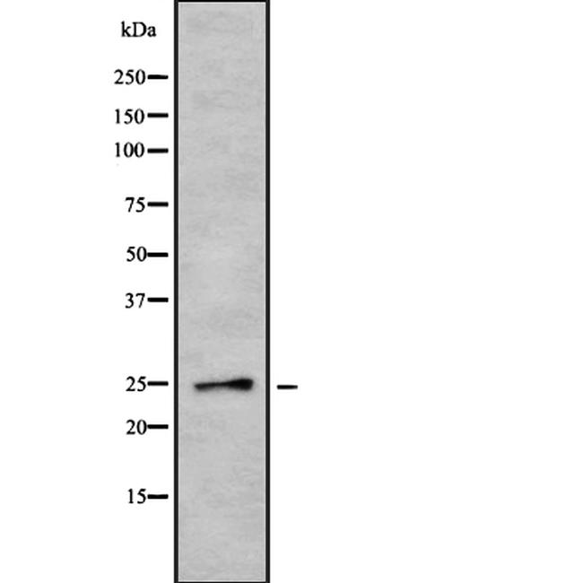 EBI3 Antibody in Western Blot (WB)