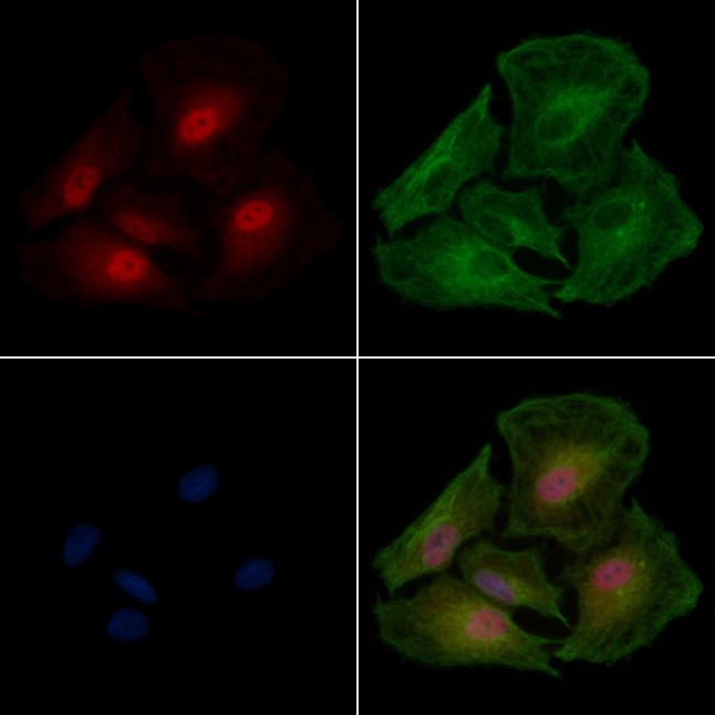 eIF4H Antibody in Immunocytochemistry (ICC/IF)