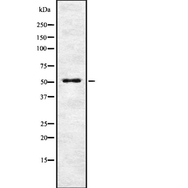ENTPD2 Antibody in Western Blot (WB)