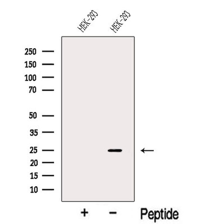 FAM3C Antibody in Western Blot (WB)