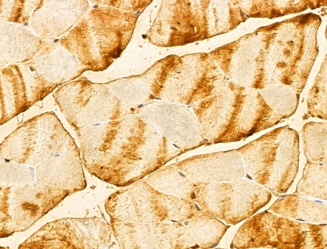 FBXO7 Antibody in Immunohistochemistry (Paraffin) (IHC (P))