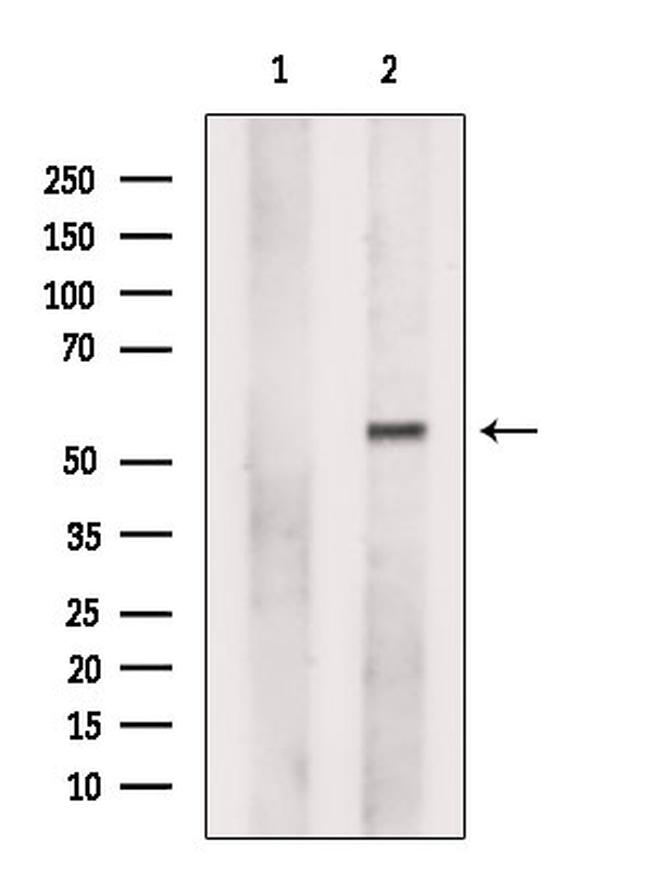 FDXR Antibody in Western Blot (WB)