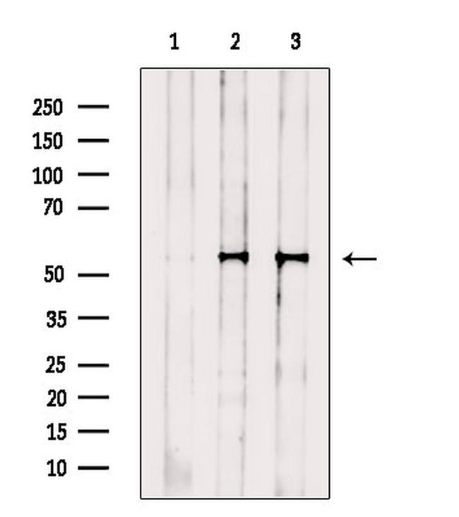 FOXF1 Antibody in Western Blot (WB)