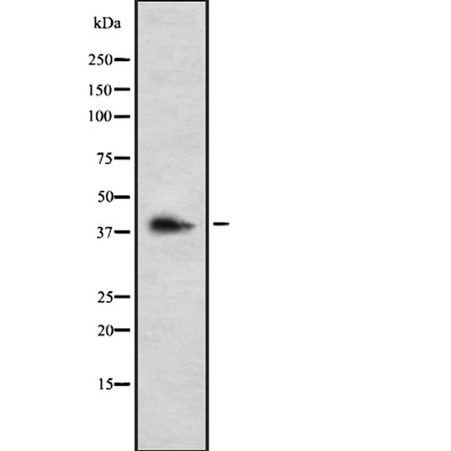 GALR3 Antibody in Western Blot (WB)