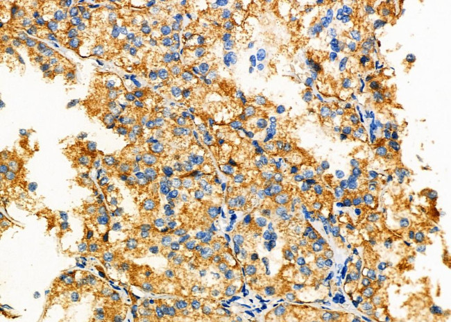 GNAS Antibody in Immunohistochemistry (Paraffin) (IHC (P))