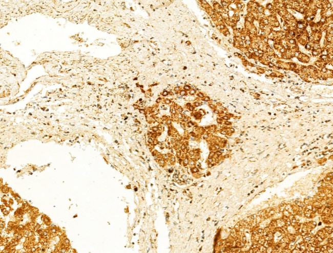 GZMB/GZMH Antibody in Immunohistochemistry (Paraffin) (IHC (P))