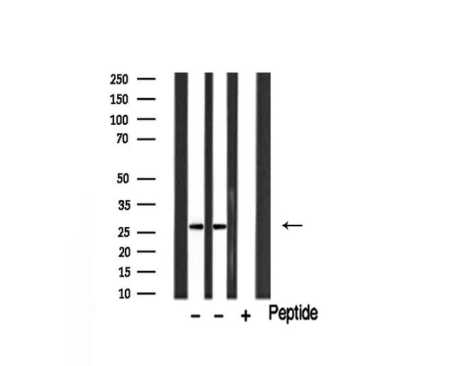 GZMB/GZMH Antibody in Western Blot (WB)