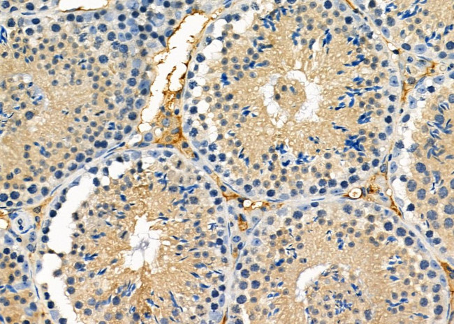 GRID2 Antibody in Immunohistochemistry (Paraffin) (IHC (P))