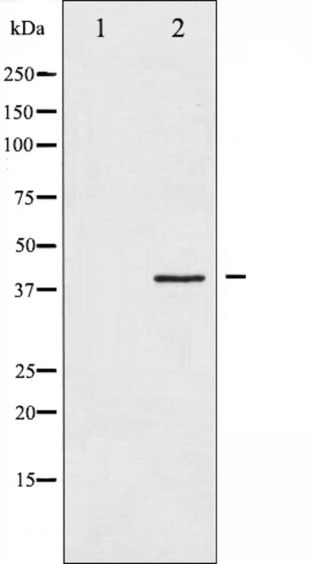 HDAC8 Antibody in Western Blot (WB)