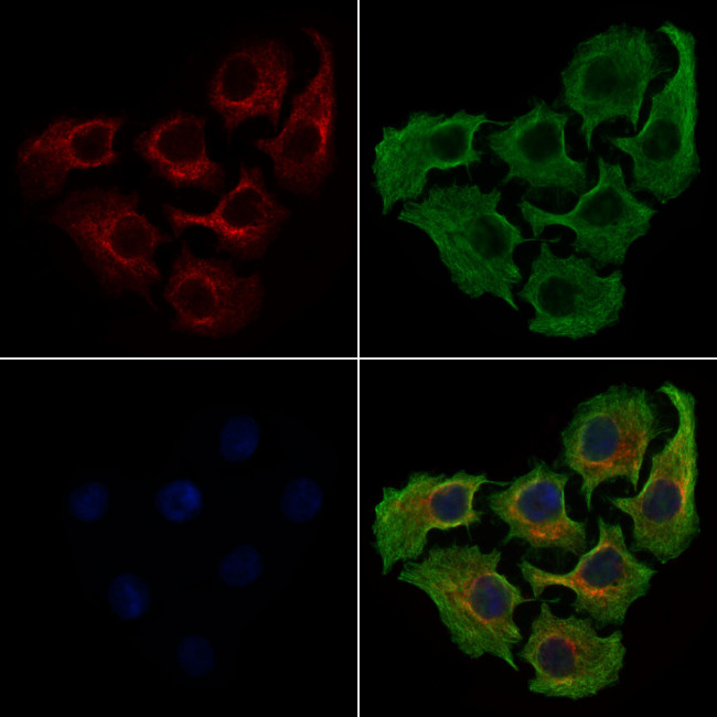 HSD17B1 Antibody in Immunocytochemistry (ICC/IF)