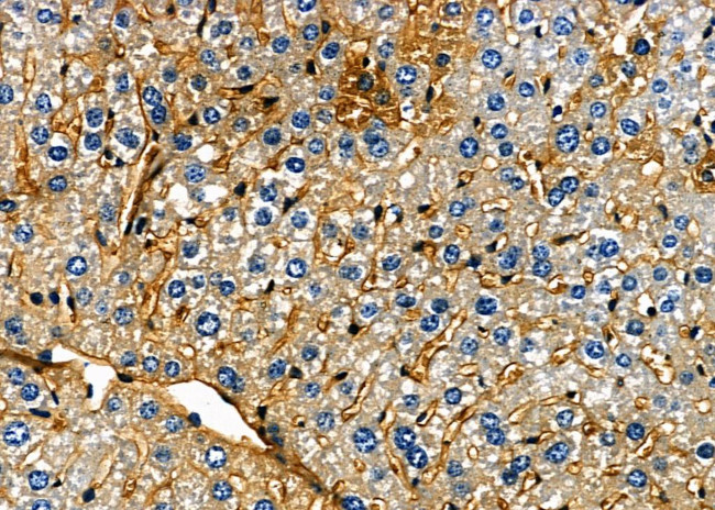 HSD17B1 Antibody in Immunohistochemistry (Paraffin) (IHC (P))