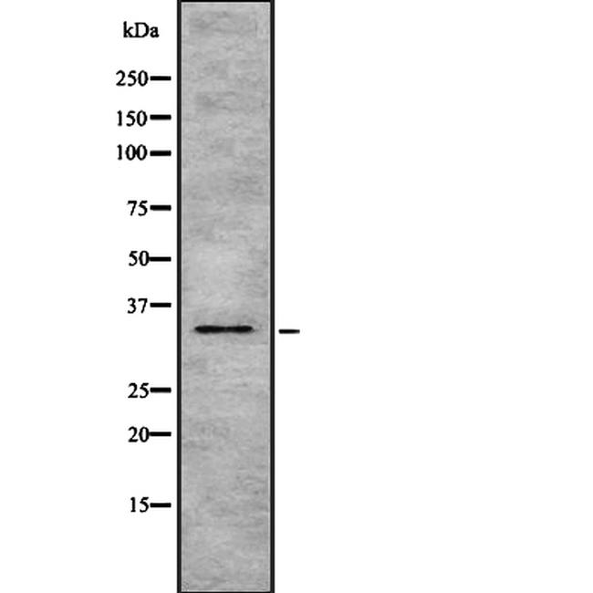 HSD17B1 Antibody in Western Blot (WB)