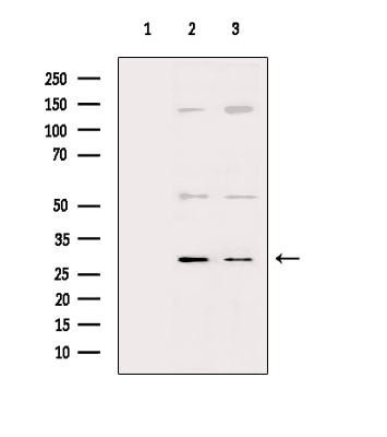 IL-4 Antibody in Western Blot (WB)