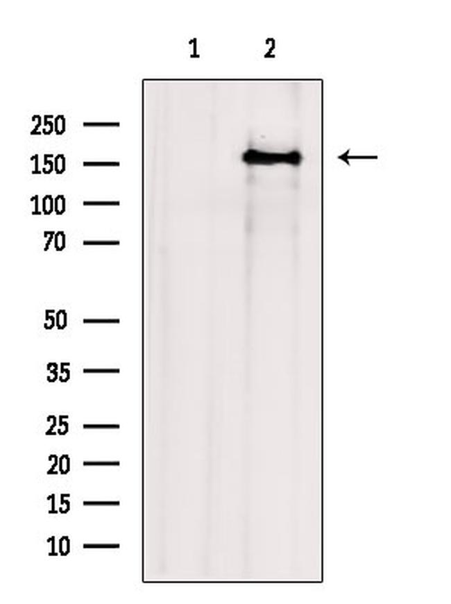 ITSN1 Antibody in Western Blot (WB)