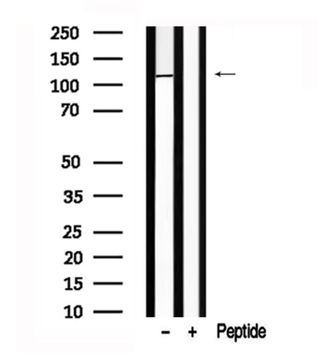 ERN1/ERN2 Antibody in Western Blot (WB)