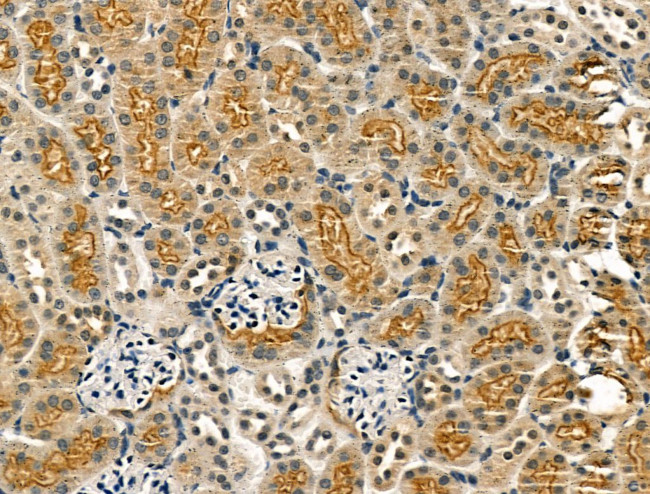 KCNN3 Antibody in Immunohistochemistry (Paraffin) (IHC (P))