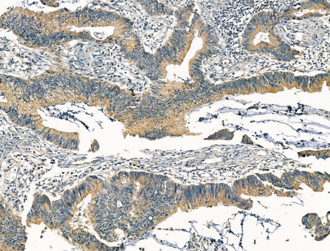 KCNN3 Antibody in Immunohistochemistry (Paraffin) (IHC (P))