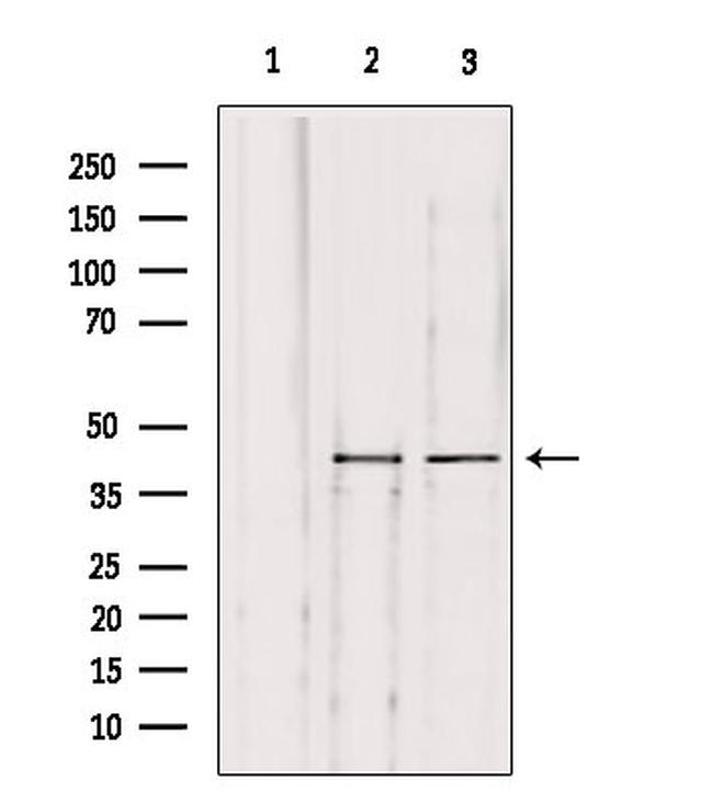 Herpes Simplex Virus Type 1 (strain SC16) Antibody in Western Blot (WB)