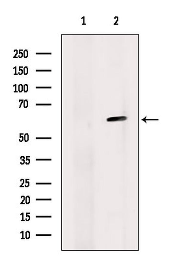 SUV420H2 Antibody in Western Blot (WB)